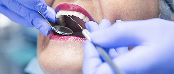 Best Emergency Dental Extractions in Wellsville, OH